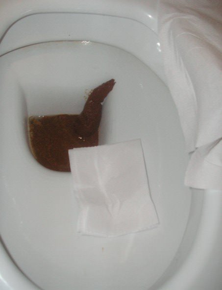 dirty poo in the toilet